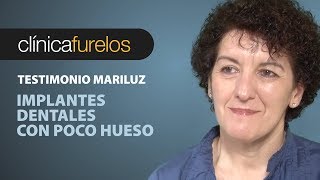 Mari Luz Implantes dentales con poco hueso [upl. by Onivla]