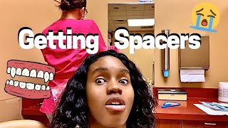 Getting Spacers for Braces MY EXPERIENCE [upl. by Enovahs683]