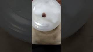 Unwanted mole remove Laser mole remove shorts youtubeshorts skintreatment moleremove [upl. by Radnaskela400]