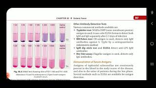 Apurba S Sastry Microbiology Enteric Fever Part 2 lab diagnosis [upl. by Sisenej]