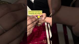 Cannula insertion of 5 month old child Cannulation nurses mbbs medicalprocedure bscnursing [upl. by Rolyab]