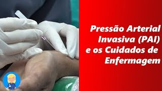 Pressão Arterial Invasiva PAI E os Cuidados de Enfermagem [upl. by Nnaeerb]