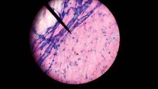 loose areolar tissue microscopic [upl. by Meryl]