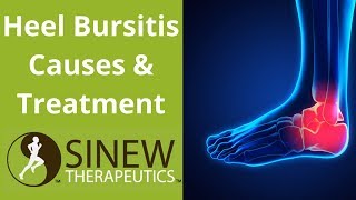 Heel Bursitis Causes and Treatment [upl. by Esertak405]