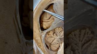 Incredible Tissue Surrounding Your Brain  Institute of Human Anatomy [upl. by Yrannav756]