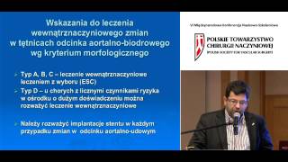 dr hab Wacław Kuczmik  Zalecenia PTChN w terapii wewnątrznaczyniowej AD 2013 [upl. by Fifi712]