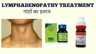 LYMPHADENOPATHY TREATMENTगांठों का ईलाज [upl. by Alarick295]