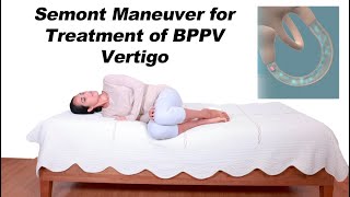 Semont Maneuver for BPPV Vertigo Treatment Alternative to Epley Maneuver [upl. by Mendel992]