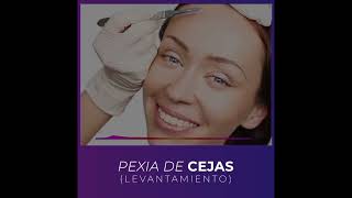 PEXIA DE CEJAS Levantamiento [upl. by Sankaran]