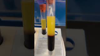 Triglycerides Levels healthylifestyle medicaleducation mzruizinstructor [upl. by Giff]