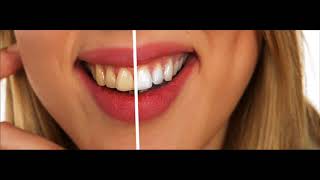 Treatment For Bruxism  Cure Healing Rife Frequency [upl. by Leen439]