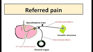 REFERRED PAIN [upl. by Kcirttap]