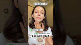 Goree day night cream  skin brightening  pigmentation  dark spots remove cream shortvideo [upl. by Nomael]