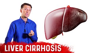 Is Liver Cirrhosis Reversible  Fibrosis vs Cirrhosis – DrBerg [upl. by Landsman]