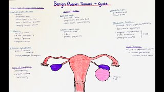 Benign Ovarian Tumors  Ovarian Cysts  histology  clinics [upl. by Peregrine]