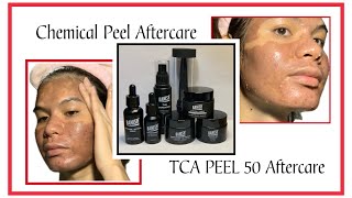 TCA PEEL AFTERCARE  TCA PEEL 50 PERCENT  TCA PEEL AT HOME diy acnescarstreatment roadtokinis [upl. by Ileane]