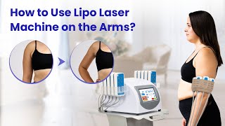 Transform Your Arms Quick and Easy Lipo Laser Machine Guide Model WLUU1401 [upl. by Micheil609]