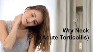 Wry Neck Acute Torticollis [upl. by Gerta]