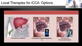 Webinar Can local therapies help patients with intrahepatic cholangiocarcinoma [upl. by Nebra]