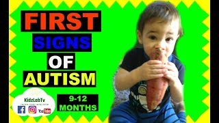 First signs of Autism 912 Months infants [upl. by Harutek919]