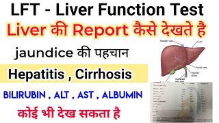 LFT  Liver function test  report कैसे देखे  AST  ALT  Bilirubin  ALP [upl. by Naiviv]