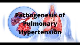 Pathogenesis of Pulmonary Hypertension [upl. by Savdeep281]