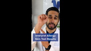 How to Understand Your Allergy Skin Test Results shorts [upl. by Notneuq]