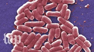 E coli infections are gross Here are 5 facts you cant unlearn about them [upl. by Ilwain]