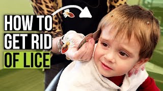 Head Lice Combing Techniques  How to Check for Lice at Home [upl. by Zolner64]