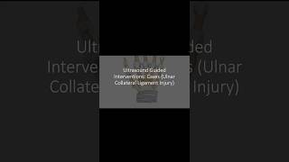 ultrasound Guided Interventions Cases Ulnar Collateral Ligament Injury fyp sportsmedicine [upl. by Namrac]