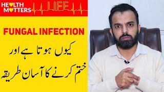 Fungal Infection Treatment  Fungal Infection of Skin In UrduHindi  Fungus Ka Ilaj [upl. by Soutor]