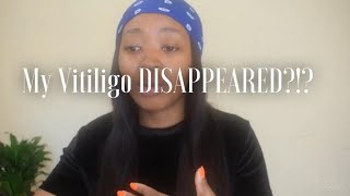 My Vitiligo Disappeared SelfLove Journey Part 2 [upl. by Zumstein32]