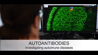 Autoantibodies investigating autoimmune diseases [upl. by Erwin]