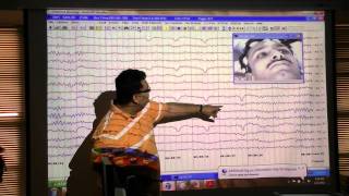 An EEG introduction [upl. by Neehar]