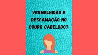 Vermelhidão e descamação no couro cabeludo o que pode ser [upl. by Novyert]