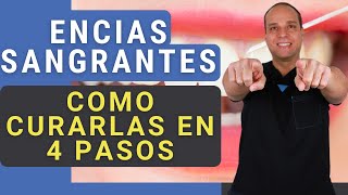 ENCIAS INFLAMADAS y SANGRANTES 😳 Como CURARLAS en 4 PASOS Funciona 😃✌ [upl. by Grodin]