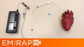 Placing a Transvenous Pacemaker [upl. by Yelreveb]