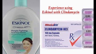 2019 Acne Story Part 1 EXPERIENCE Eskinol with dalacin cclindamycin [upl. by Takakura]