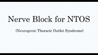 Nerve Block Treatment for Thoracic Outlet Syndrome TOS [upl. by Carilyn]