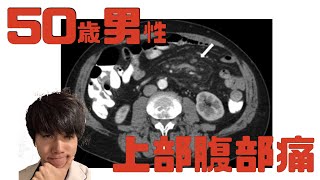 【わかったらすごいかも！？】50歳男性上腹部痛の症例BMJ case reportsから [upl. by Mandy]