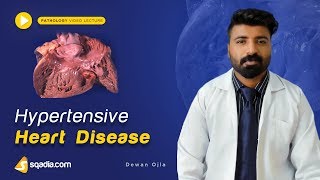 Hypertensive Heart Disease  Medical Pathology  Textbook Online Lectures  VLearning [upl. by Scotti]