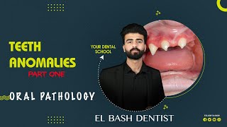 developmental anomalies  teeth anomalies 1 oral pathology عزت شومان [upl. by Namolos362]