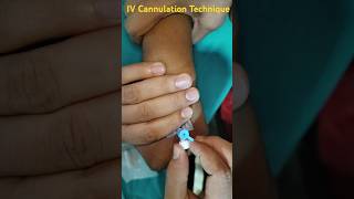 192 IV Cannulation Technique Videos reels [upl. by Alegnad]