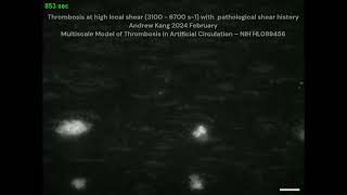 Thrombosis at High Local Shear 3100  6700 s1 with Pathological Shear History [upl. by Vaclava]