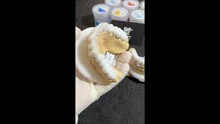 emax zirkonyum cutback diş dentalclinic reels veneers [upl. by Lesna]