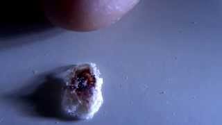 Morgellons transhumanism microrobottracker What is it [upl. by Germaine700]