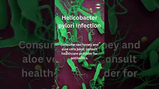 Helicobacter Pylori Infection Of the Stomach [upl. by Tiersten]