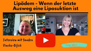 Lipödem  Wenn der letzte Ausweg eine Liposuktion ist [upl. by Akeenahs]