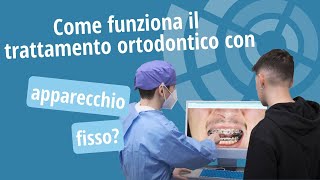 Trattamento ortodontico con apparecchio fisso come funziona  Studio Ortodontico Cocconi Rapa [upl. by Brittne624]