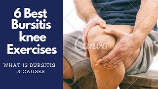 6 Best Bursitis Knee Pain Exercises amp Physiotherapy [upl. by Chaille]